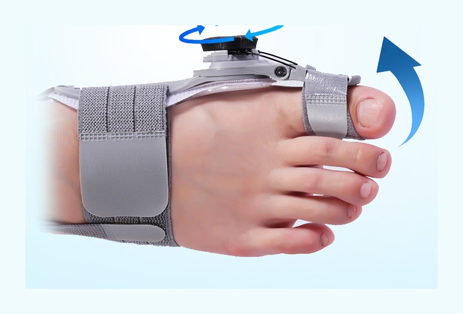 Bunion Fix aplicado no pé, mostrando a dobradiça ajustável